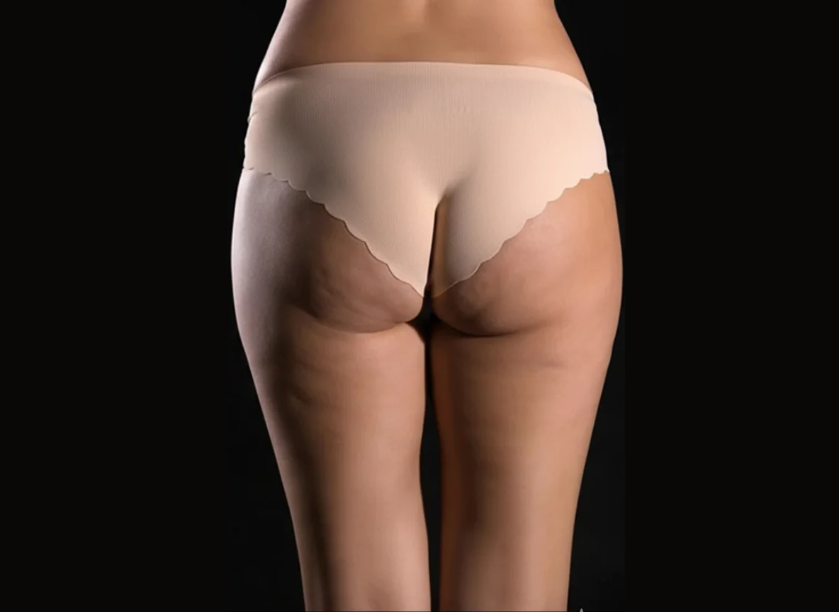 Masajeador Anticelulítico Vibratorio Body Sculptural